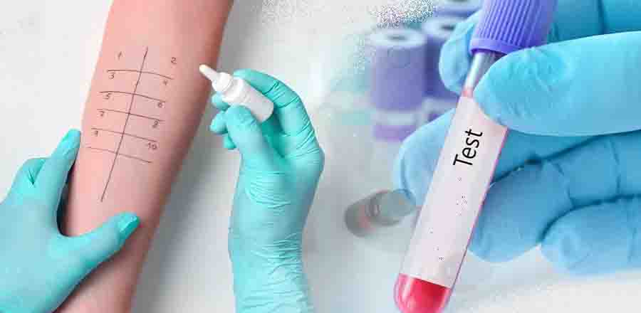 Allergy Test 2 Αλλεργικά Τεστ: Τι Είναι, Πότε Γίνονται και Πόσο Αξιόπιστα Είναι 2 allergy test