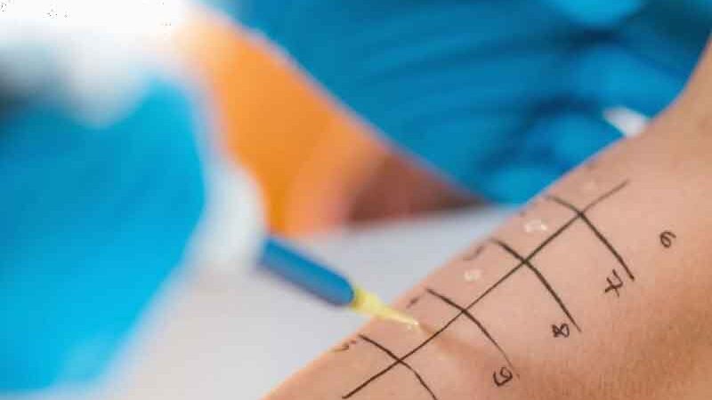 Allergy Test 2 Αλλεργικά Τεστ: Τι Είναι, Πότε Γίνονται και Πόσο Αξιόπιστα Είναι