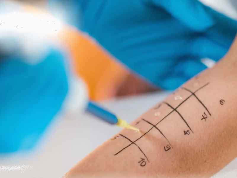 Allergy Test 2 Αλλεργικά Τεστ: Τι Είναι, Πότε Γίνονται και Πόσο Αξιόπιστα Είναι