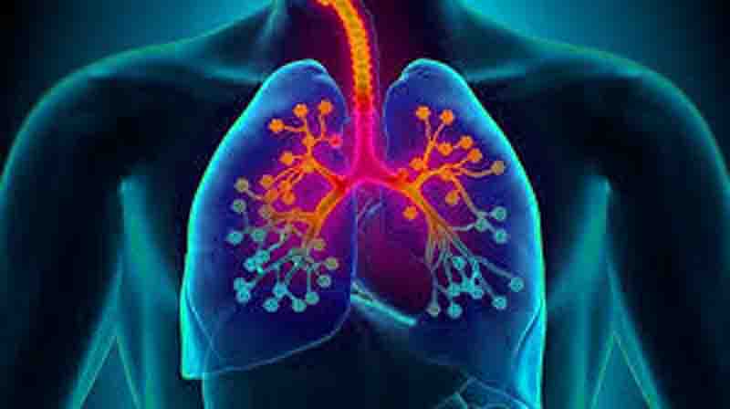 Bronchial Asthma Βρογχικό άσθμα προκαλεί περιορισμό του αέρα και μεταβαλλόμενη στένωση των βρόγχων 3 bronchial asthma