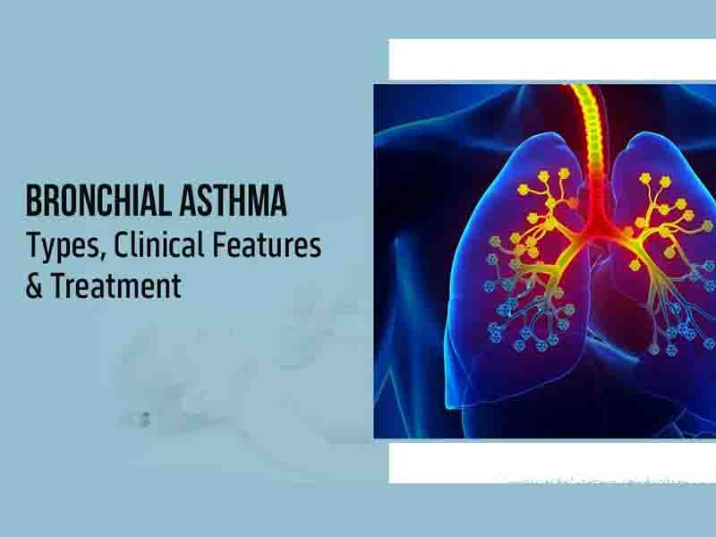Bronchial Asthma Βρογχικό άσθμα προκαλεί περιορισμό του αέρα και μεταβαλλόμενη στένωση των βρόγχων